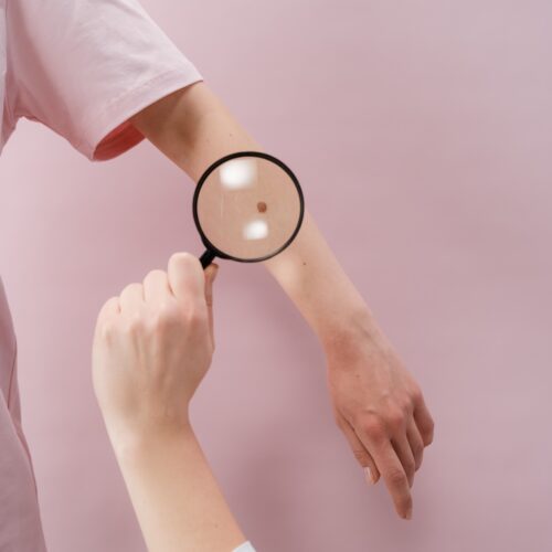 risk prediction models for melanoma